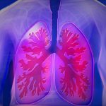 How to Know if You Are Suffering from a Pulmonary Embolism and What You Need to do