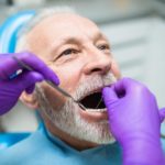 Why Dental Coverage is Important for Aging Parents