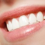 Great Tips and Advice to Help You Lower Invisalign Replacement Costs