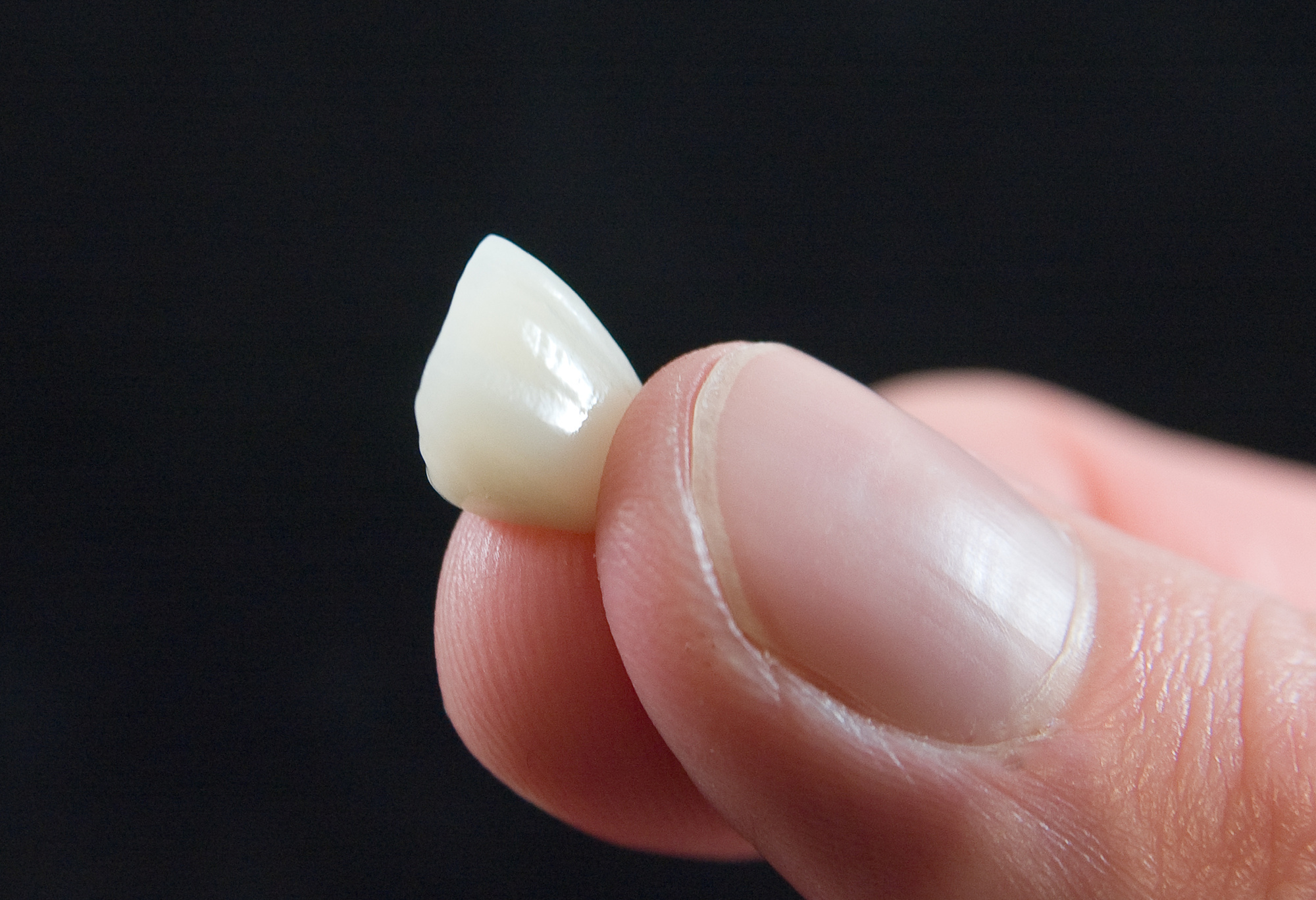 how are dental crowns made