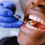 This Is How Much a Dental Visit Will Cost You (With or Without Insurance)