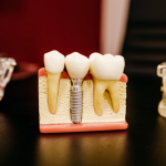 5 Tips For Selecting a Dentist