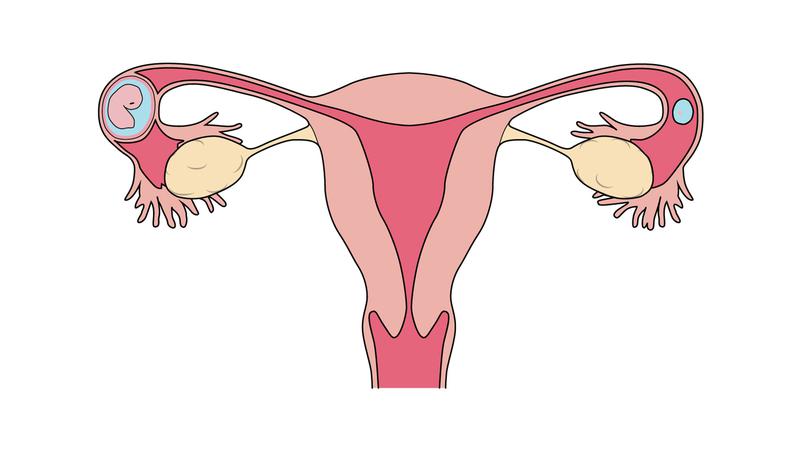 Ectopic Pregnancy Symptoms, Causes, and Treatment To Know About
