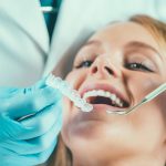 Cosmetic Teeth Reshaping - A Complete Guide