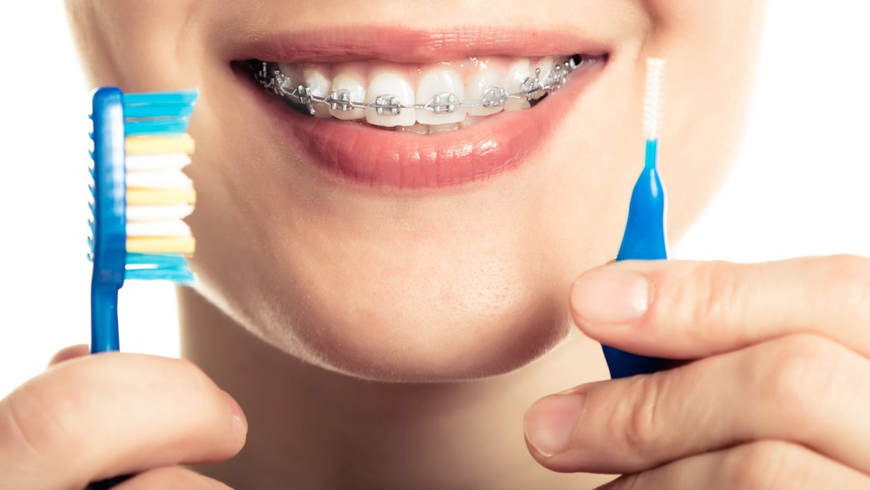4 Tips for Maintaining Healthy Teeth Before and After Orthodontic Treatment