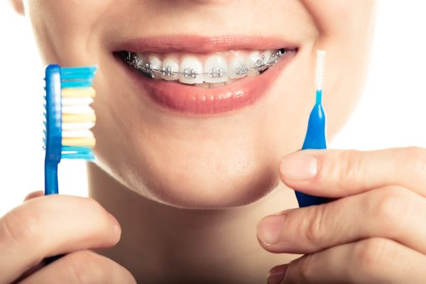 4 Tips for Maintaining Healthy Teeth Before and After Orthodontic Treatment