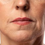 The Anti-Aging Miracle: How NMN Helps Smooth Fine Lines and Reduce Jowl Sagging