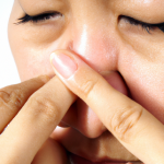 how to relieve sinus pressure with fingers